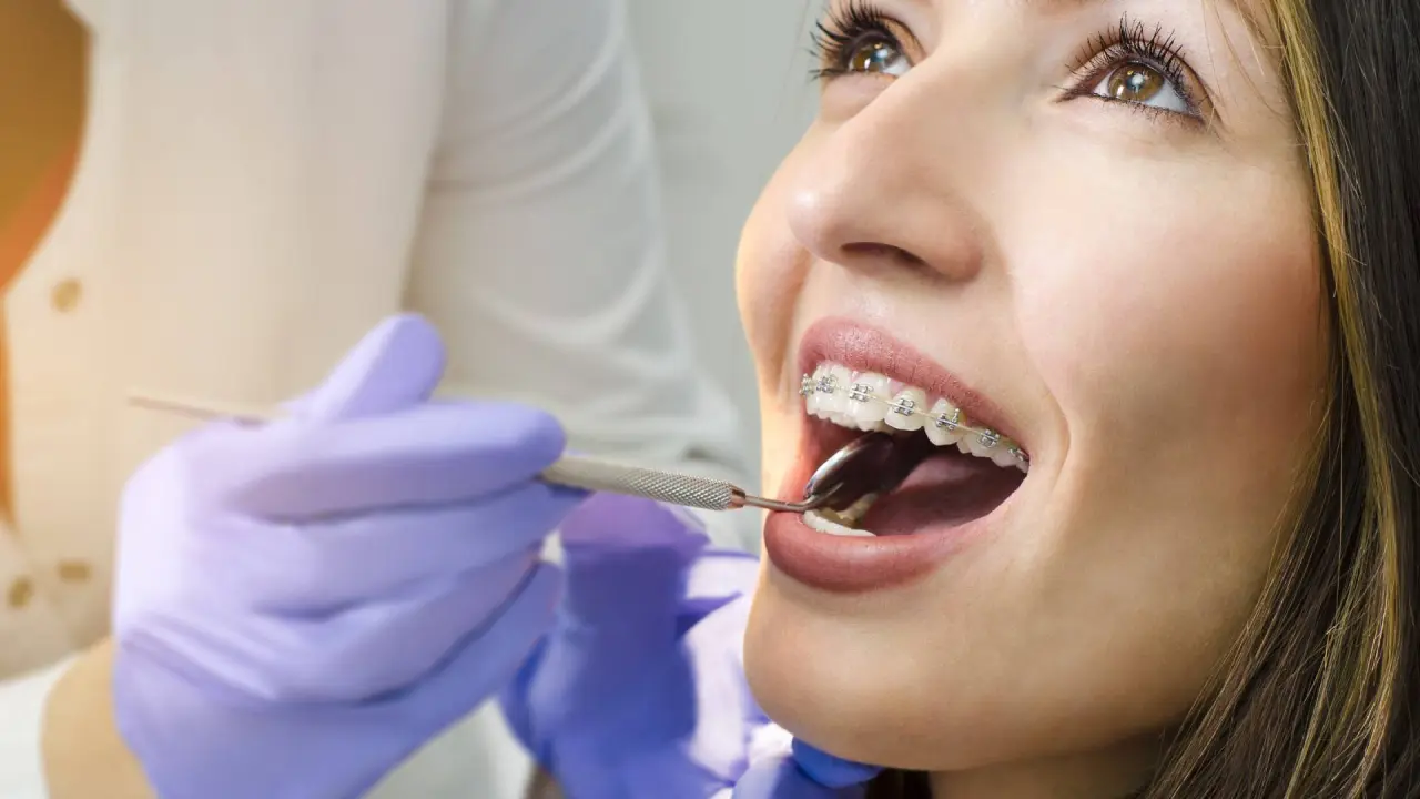 a dentist installs braces in a patient at a specialized practice