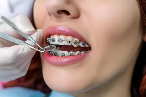 Orthodontic Office in Brooklyn