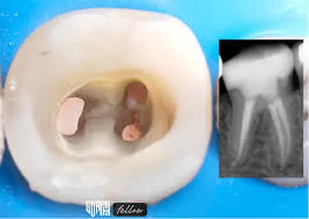 Morris County Endodontic Practice